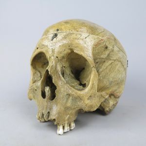Human skull 1
