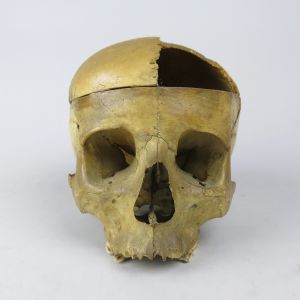 Human skull 6