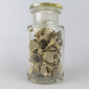 Large jar human vertebrae pieces